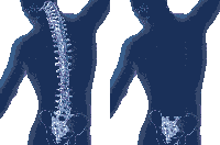 spine spineless